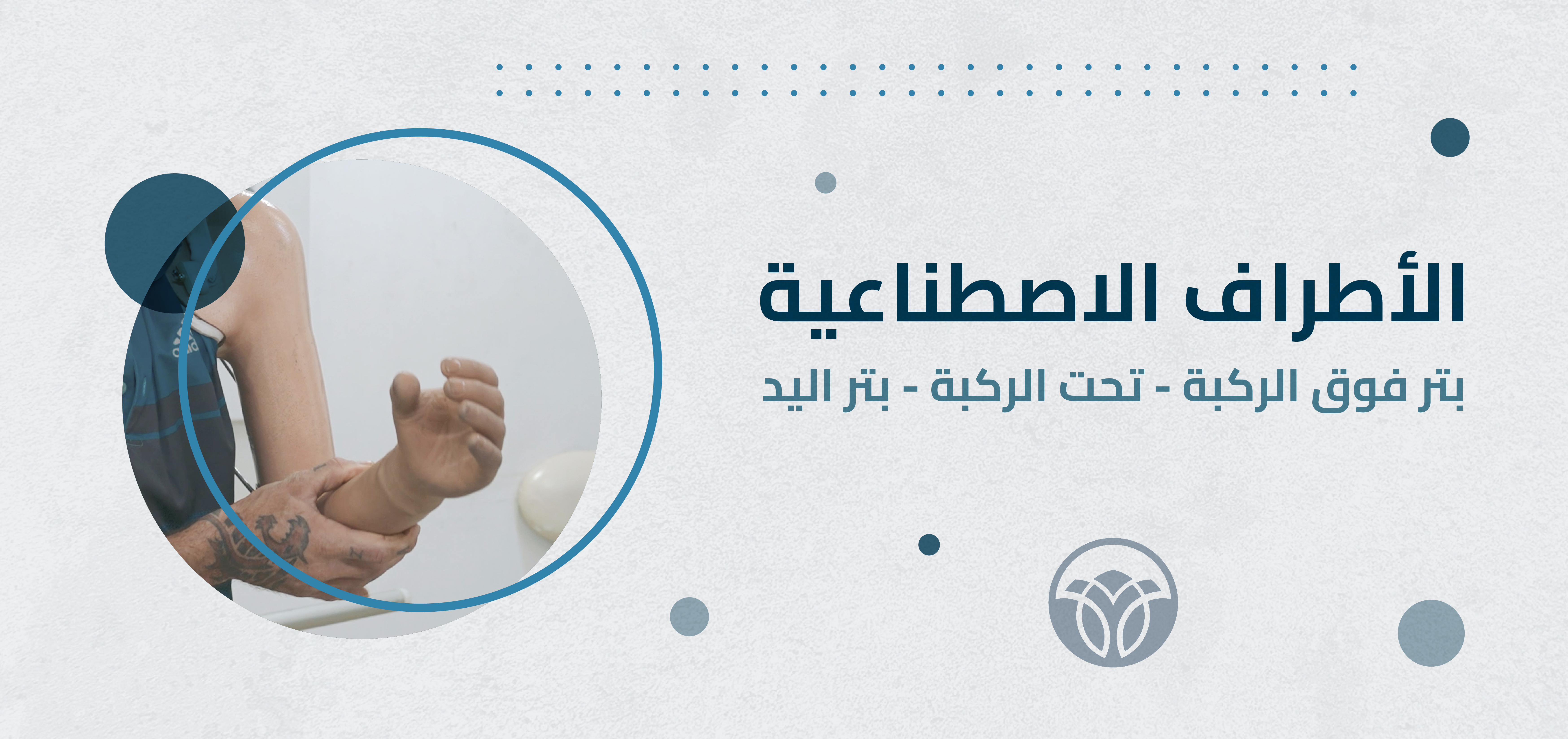 الأطراف الإصطناعية